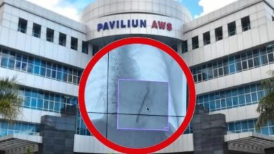 RSUD Abdul Wahab Sjahranie (AWS) Samarinda dan kawat medis yang tertinggal di jantung pasien